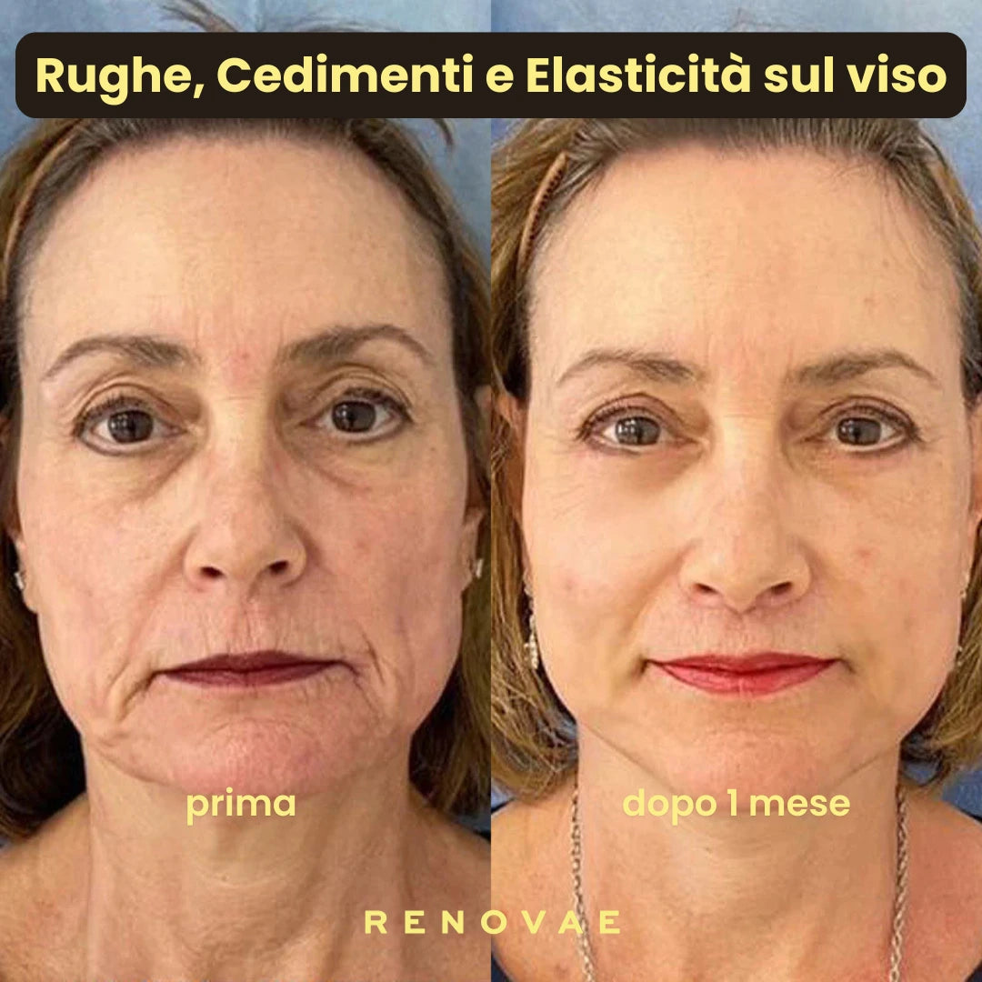 Pack Kit Micro-Infusione