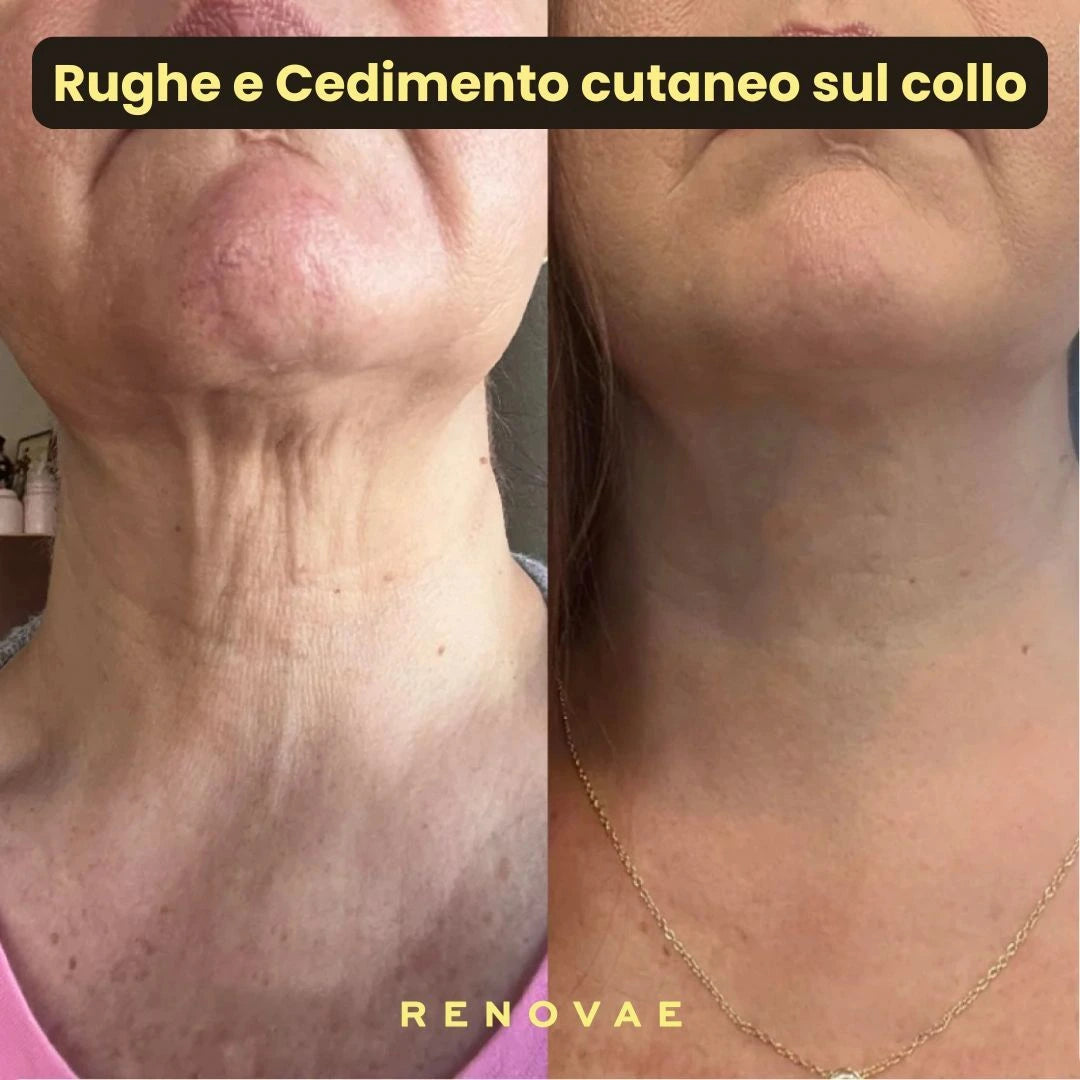 Pack Kit Micro-Infusione