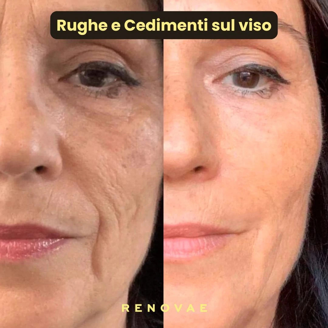 Pack Kit Micro-Infusione