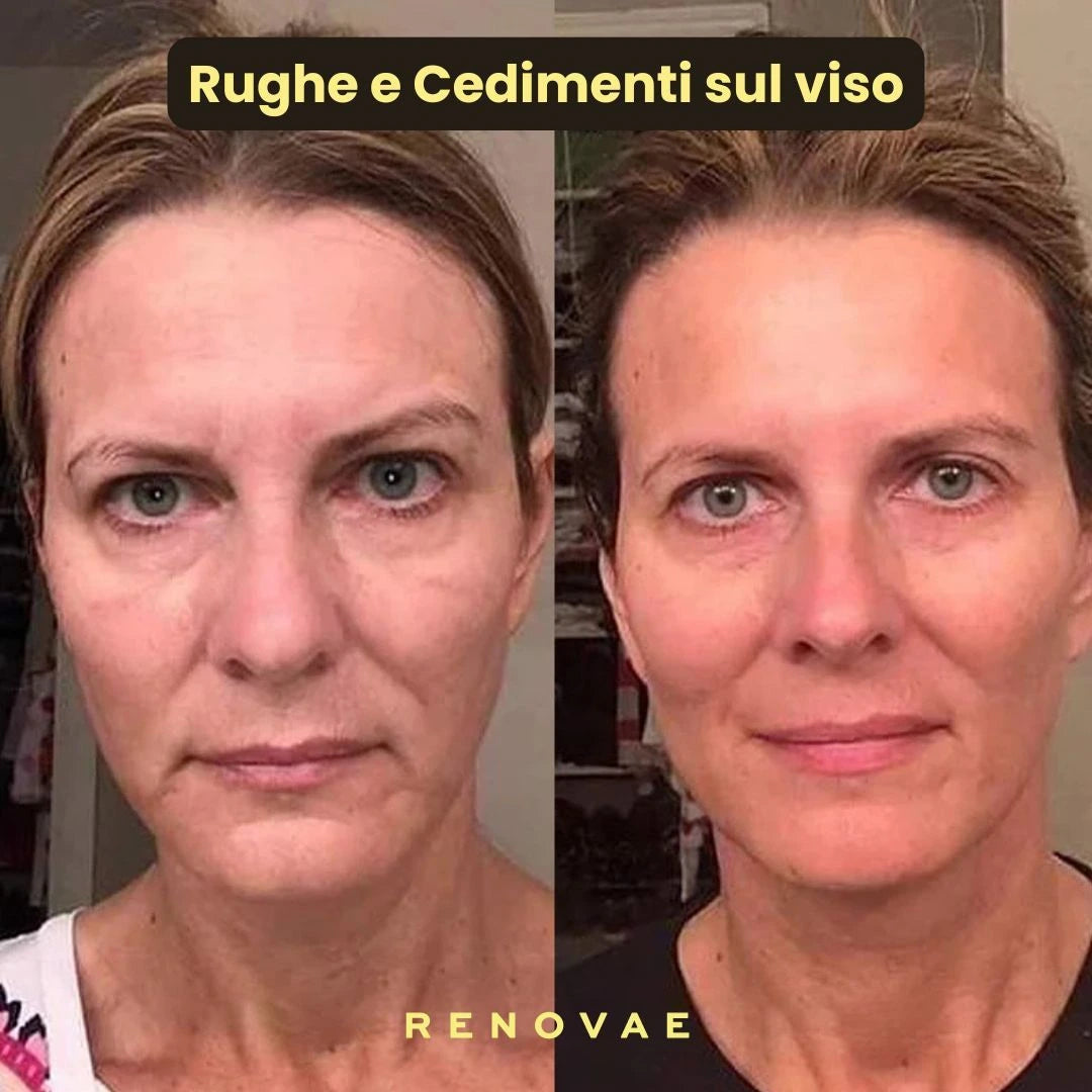 Pack Kit Micro-Infusione